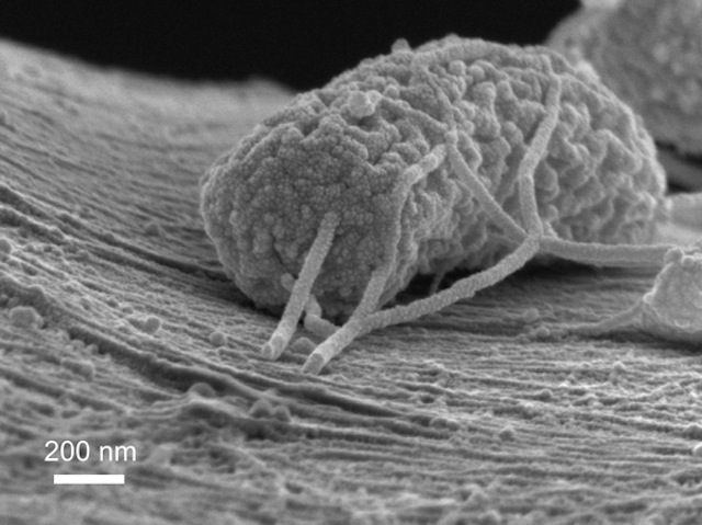 'WIRED MICROBE.' The tubular growth depicted here is a type of microbe that can produce electricity. Its wire-like tendrils are attached to a carbon filament. This image is taken with a scanning electron microscope. Photo courtesy Xing Xie, Stanford Engineering