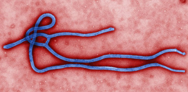 BOLA. This colorized transmission electron micrograph (TEM) obtained March 24, 2014 from the Centers for Disease Control (CDC) in Atlanta, Georgia, reveals some of the ultrastructural morphology displayed by an Ebola virus virion. Photo by Cynthia Goldsmith/CDC/AFP