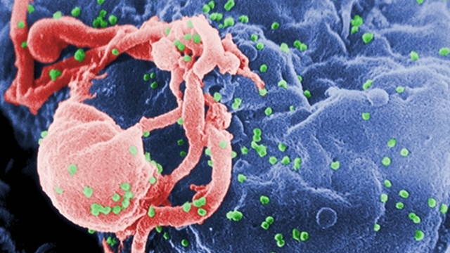 MODERN DAY SCOURGE. The HIV virus. (Photo credit: C. Goldsmith/public domain)