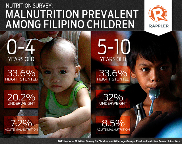 CHILDREN'S HEALTH. A study conducted by the Food and Nutrition Research Institute shows malnutrition is prevalent in Filipino children. Graphic by Raffy de Guzman