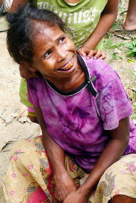 NGANGA. This indigenous woman has reddish teeth from chewing nganga (betel nut)