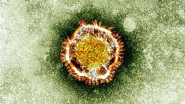 DEADLY VIRUS. This undated handout picture courtesy of the British Health Protection Agency shows the Coronavirus seen under an electron microscope. Photo by AFP/British Health Protection Agency