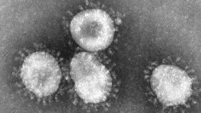 MYSTERY VIRUS. Coronavirus under the microscope. Photo from Wikipedia