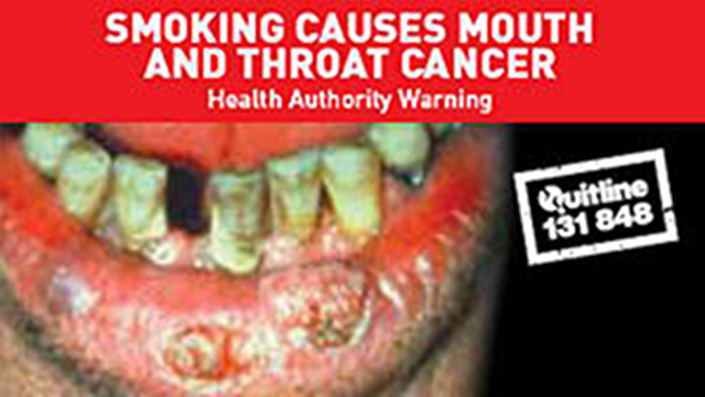 MOST EFFECTIVE. Senators Pia Cayetano and Franklin Drilon say graphic health warnings are the most effective way to discourage Filipinos from smoking. The image is a sample graphic warning used by the Australian government, and posted on the WHO's website. 