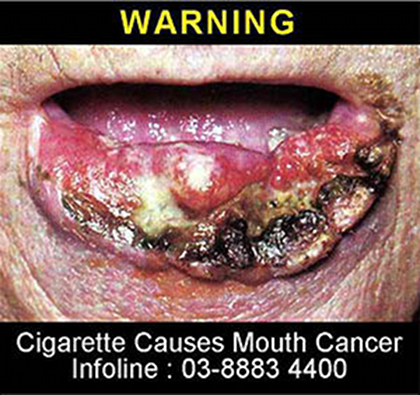 Image owned by the Ministry of Health, Thailand. Image from who.int 
