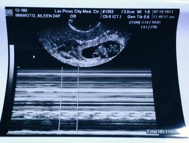 EXCITED FIRST-TIME MOM. Iwa posted this ultrasound photo of her 'alien' on her Facebook page on February 19