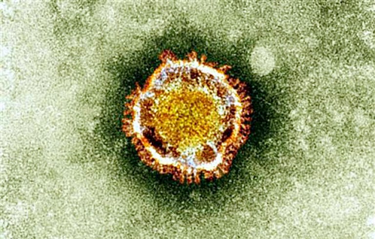 DEADLY NEW VIRUS. This undated handout picture courtesy of the British Health Protection Agency shows the Coronavirus seen under an electron microscope. AFP PHOTO / British Health Protection Agency