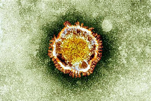 DEADLY NEW VIRUS. This undated handout picture courtesy of the British Health Protection Agency shows the Coronavirus seen under an electron microscope. Photo by AFP / British Health Protection Agency
