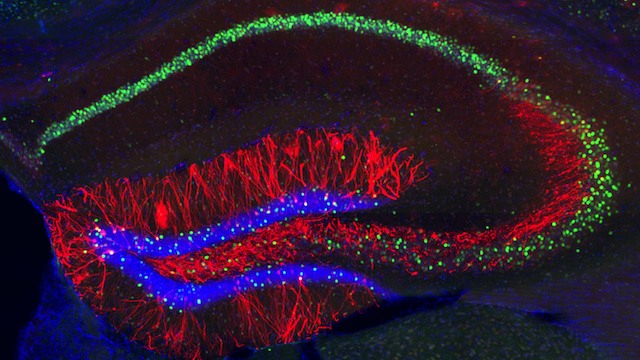 MIT neuroscientists identified the cells (highlighted in red) where memory traces are stored in the mouse hippocampus. Image courtesy of Steve Ramirez & Xu Liu/MIT