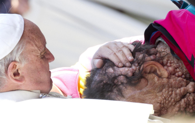 'JOY OF THE GOSPEL.' Challenging his flock to share joy with others, Pope Francis embraces a disfigured man in November. Photo by Claudio Peri/EPA
