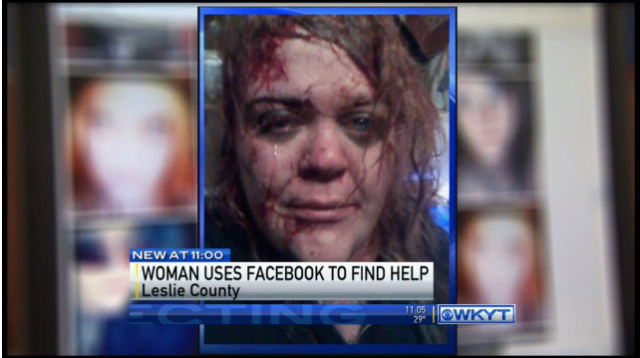BLOODY SELFIE. Susann Stacy posted this image of her on Facebook as a cry for help. Screengrab from WKYT News' video.