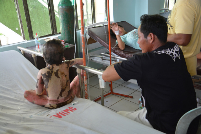 TENT TRAGEDY. John Mark Ocenar (left), 7, is treated in a hospital before he dies due to cardiac arrest, says Tacloban Mayor Alfred Romualdez. Photo courtesy of Tacloban City government