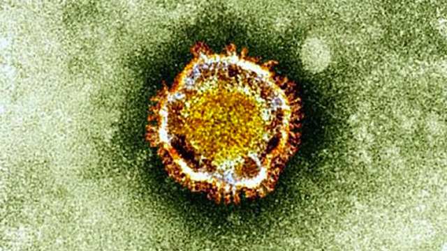 DEADLY NEW VIRUS. This undated handout picture courtesy of the British Health Protection Agency shows the Coronavirus seen under an electron microscope. AFP PHOTO / British Health Protection Agency