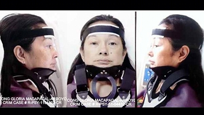 Former President Arroyo's alleged mugshots